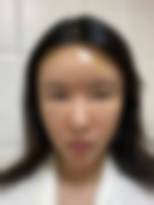 二、新疆乌鲁木齐张瑞红医疗美容诊所怎么样？