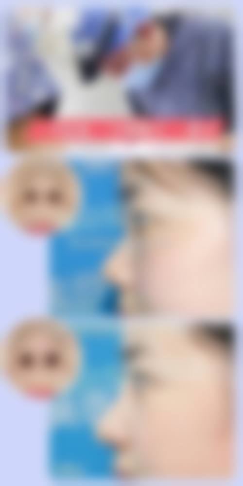 六、韩国S-ONE整形外科医院价格表