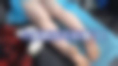 八、长春华美整形美容院真实的患者评价