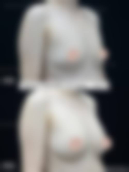 二、深圳天美整形美容医院怎么样？