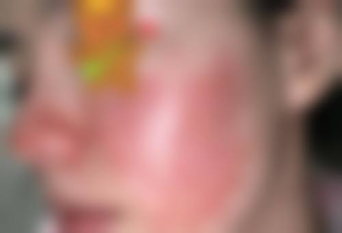 八、韩国S-ONE整形外科医院预约方式