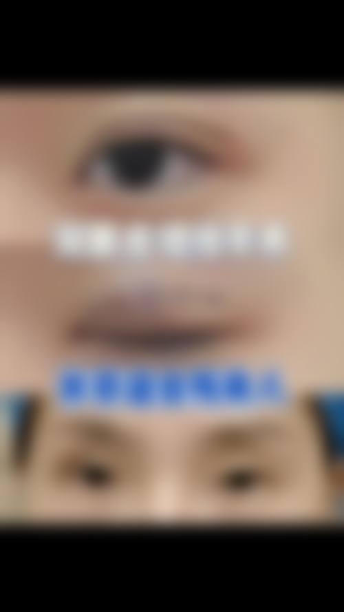 四、长春华美整形美容院特色项目