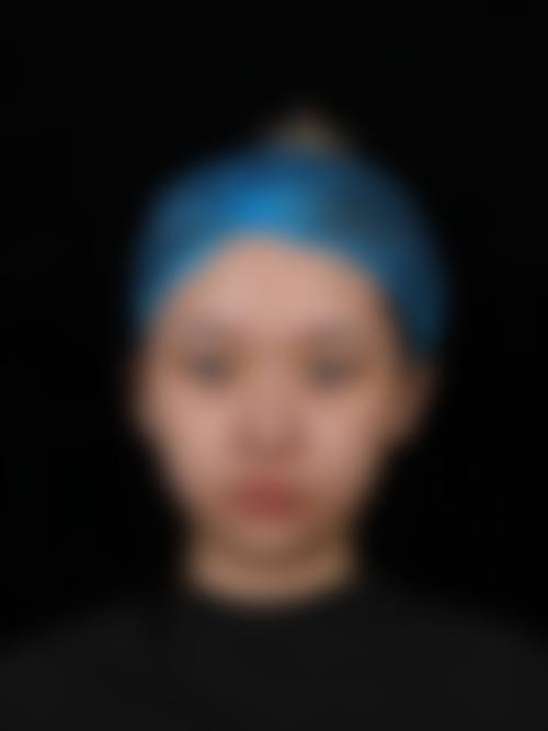 三、长春华美整形美容院诊疗项目有哪些？