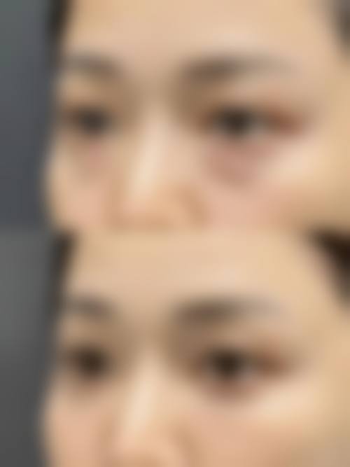 七、长春华美整形美容院预约方式