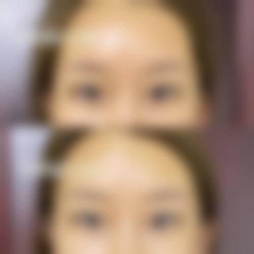 八、济南九紫嘉美整形医院真实的患者评价