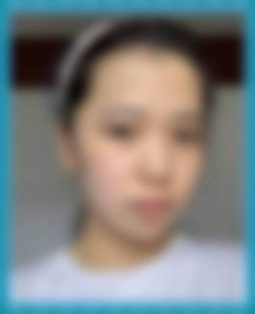 四、济南九紫嘉美整形医院特色项目