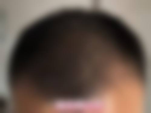 二、莱芜市人民医院整形烧伤科怎么样?