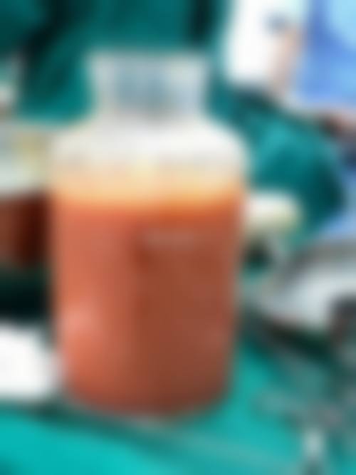 五、长春华美整形美容院价格表