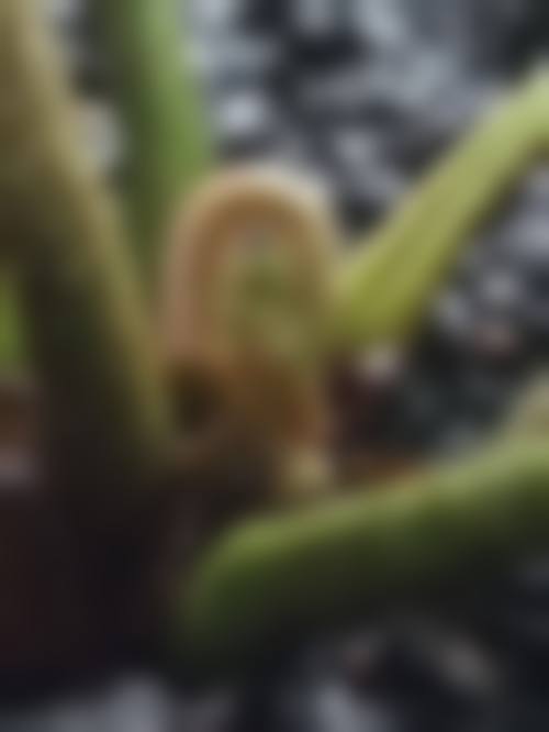 四、韩国S-ONE整形外科医院特色项目