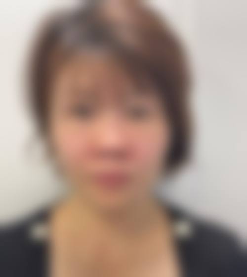 九、新疆乌鲁木齐张瑞红医疗美容诊所真实的患者评价