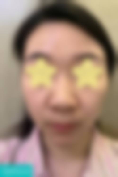 四、新疆乌鲁木齐张瑞红医疗美容诊所特色项目