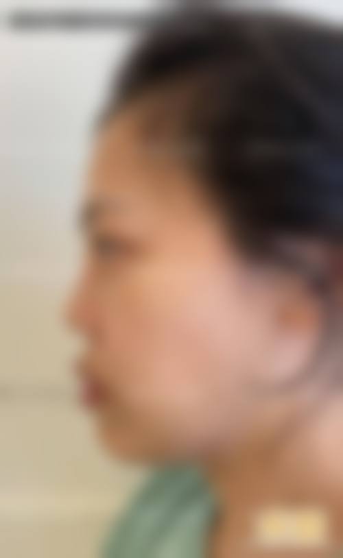 九、四平杨玉杰美容院真实的患者评价