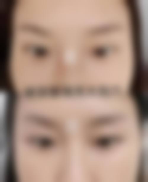 三、韩国S-ONE整形外科医院诊疗项目有哪些？