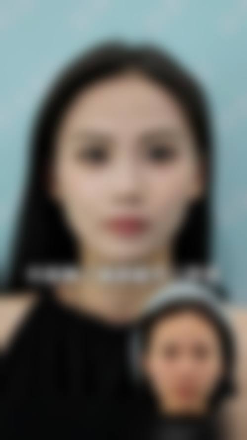 八、连江县靓馨颜整形医院真实的患者评价