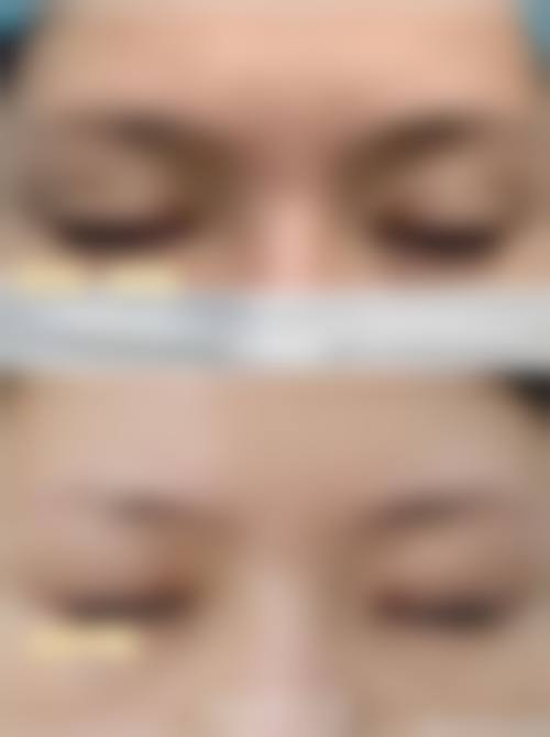 九、潍坊华美创和整形医院（华北旗舰院）真实的患者评价