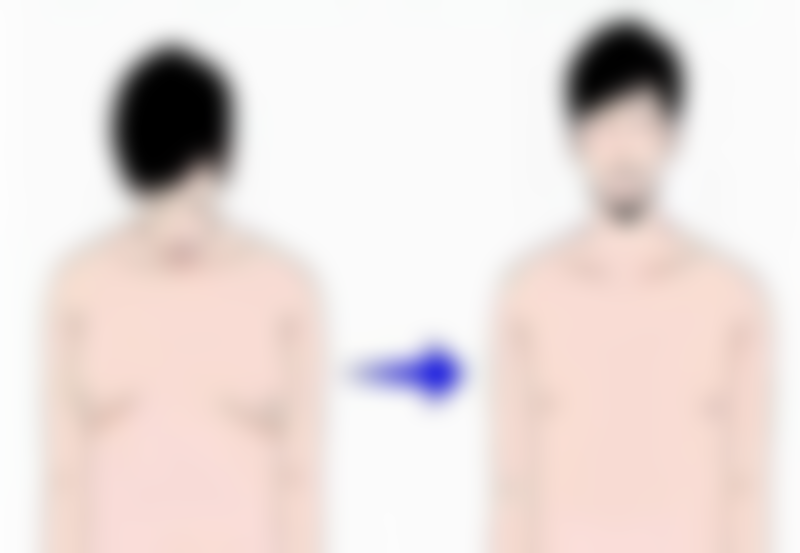 五、打瘦脸针的风险提示