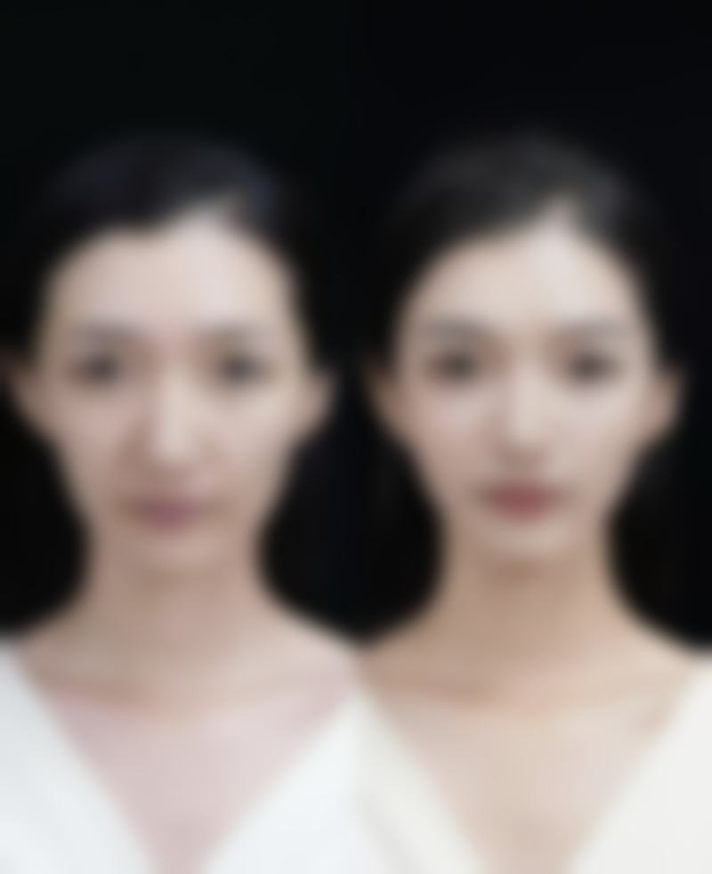 二、郑州菲林整形医院怎么样？