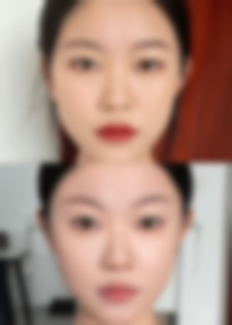 哪个美容院做双眼皮效果好？多地优质机构推荐及丽江悦莱美优势揭秘