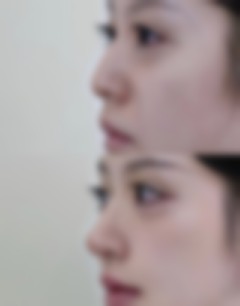 四、韩国slimyoung clinic医院特色项目