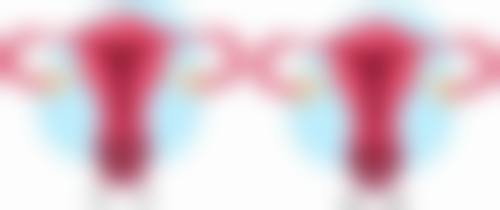 三、假体隆胸失败取出假体后的修复时间