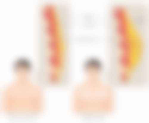 一、隆胸术后的基本修复时间