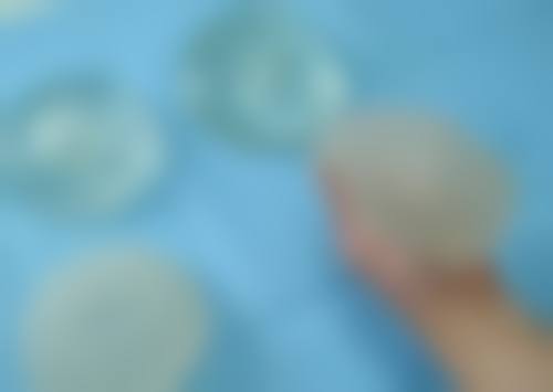 三、吸脂减肥整形的其他注意事项