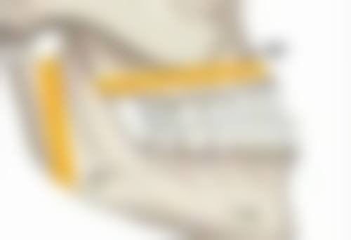 五、影响隆胸修复时间的其他因素