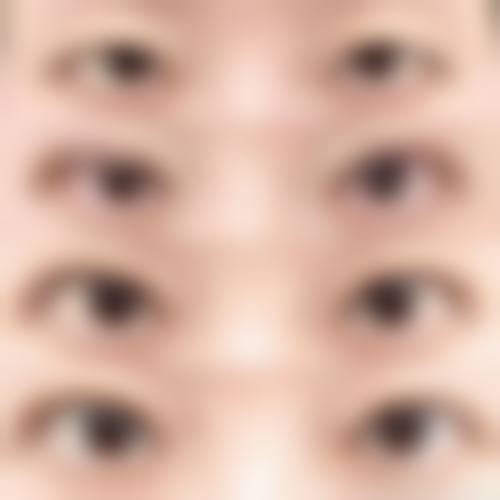 八、沈阳美联致美整形医疗美容门诊部真实的患者评价