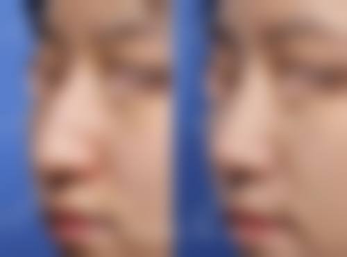 九、广元华 西医学整形美容诊所真实的患者评价