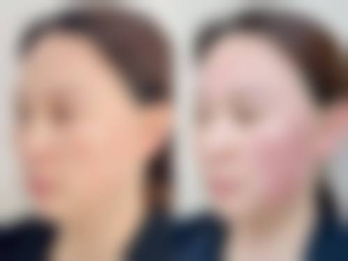 五、沈阳市金皇后医疗美容门诊部价格表