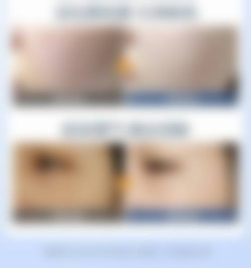 八、深圳赫思名品整形医院预约方式