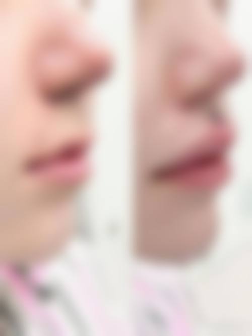 六、长春天慈医院整形美容科价格表