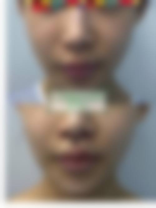 四、深圳赫思名品整形医院特色项目