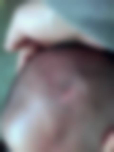 四、成都娥皇奢美汇医疗美容诊所特色项目