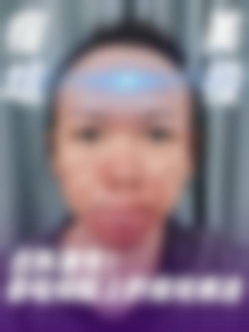 九、长沙欣姿美医疗美容门诊部真实的患者评价