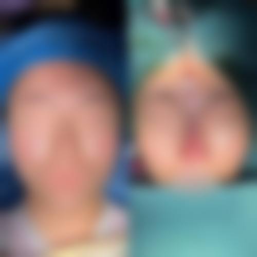 四、山东淄博博山烧伤整形医院特色项目