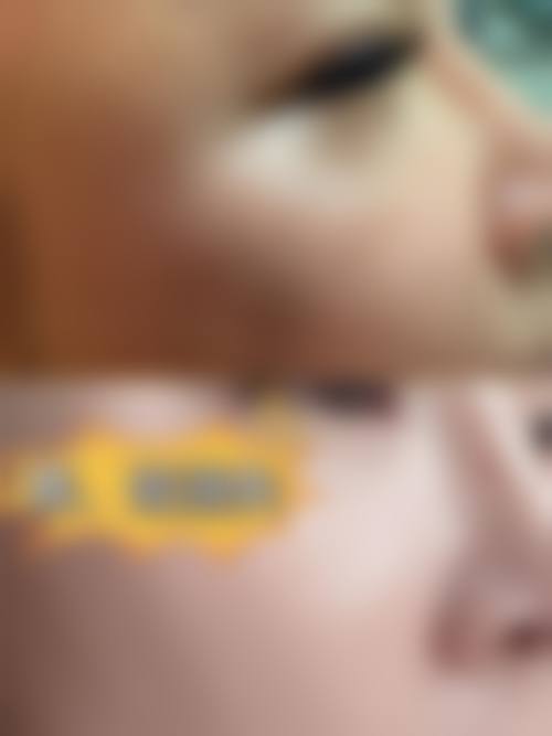 八、营口关利云美容诊所真实的患者评价