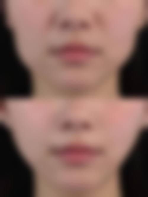 八、山东淄博博山烧伤整形医院真实的患者评价