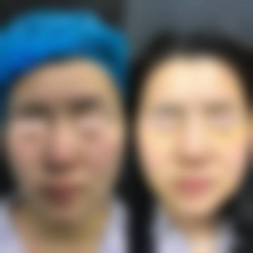 四、北京广济中医和西医结合医院胎记疤痕诊疗中 心特色项目