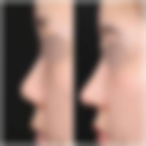 六、北京广济中医和西医结合医院胎记疤痕诊疗中 心价格表