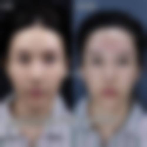 二、沈阳市金皇后医疗美容门诊部怎么样？