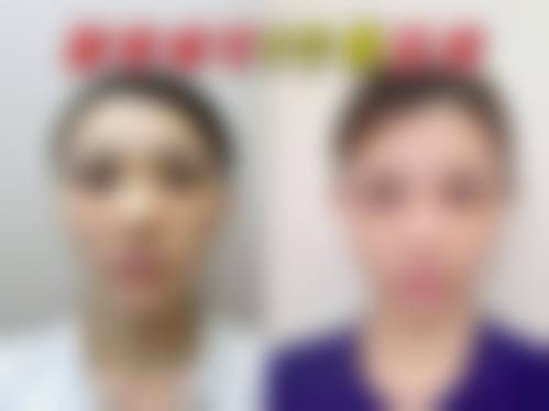 四、龙岩协和整形美容医院特色项目