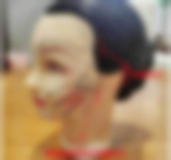 三、手术过程与感受