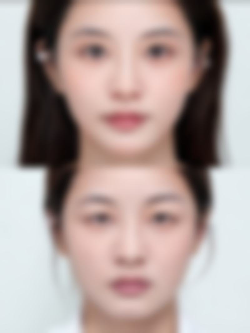 八、沈阳铭医优选医疗美容门诊部真实的患者评价