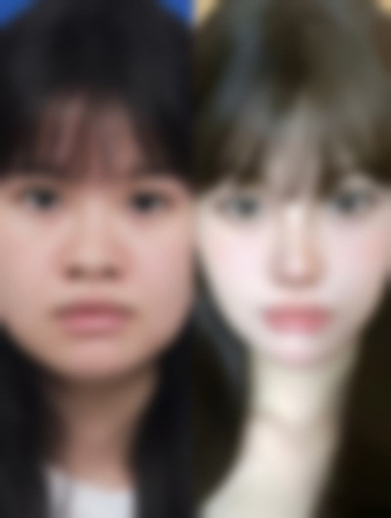 六、其他去眼袋方法对比