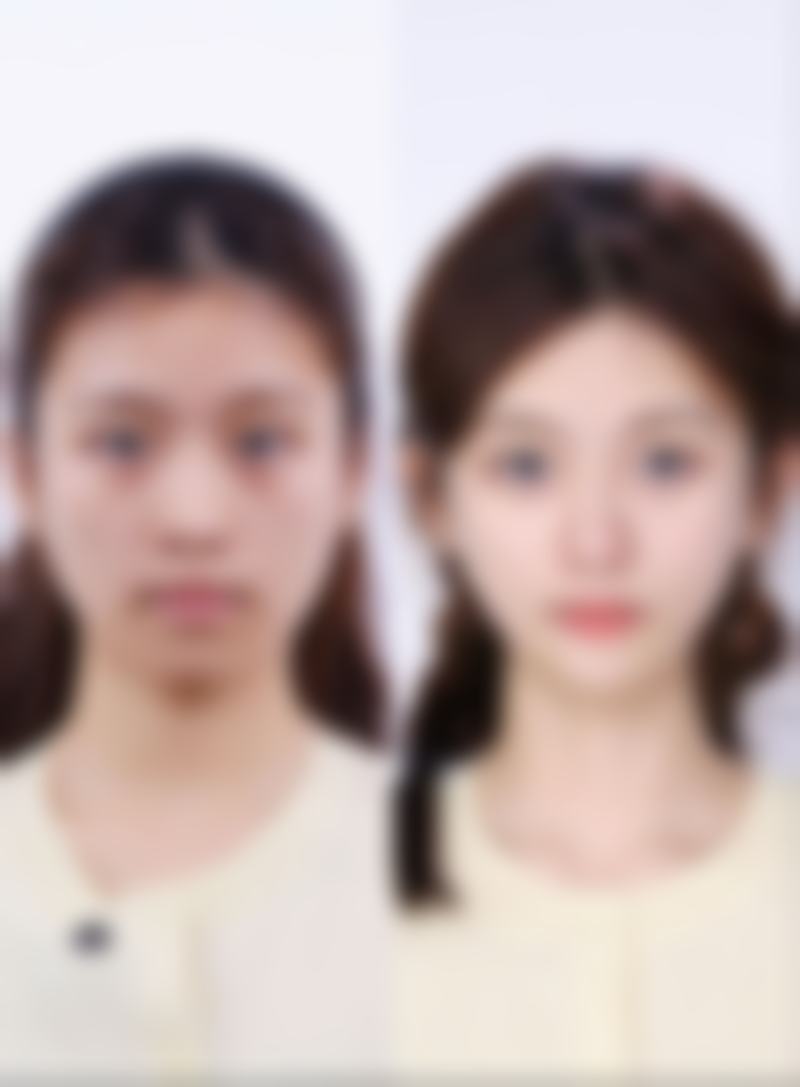 一、敷面膜可以去眼袋吗？原因大剖析