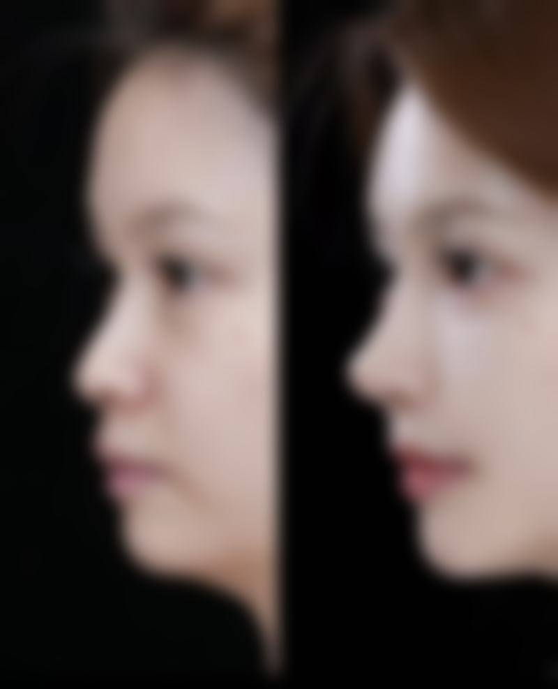 一、富贵包成因大揭秘