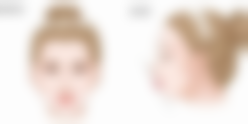 四、怎样降低眼袋切除后遗症的发生概率