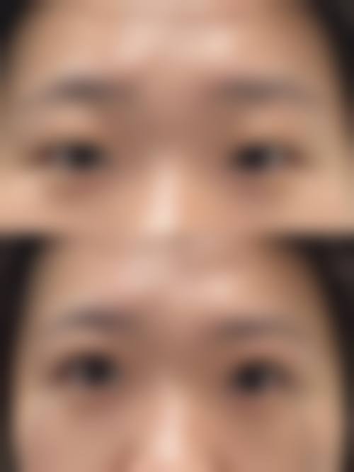 八、临汾高新烧伤外科医院真实的患者评价