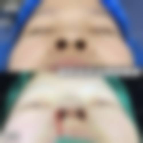 一、长沙安吉娜医疗美容门诊部正规吗？